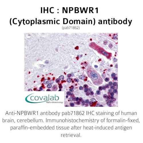 NPBWR1 (Cytoplasmic Domain) antibody