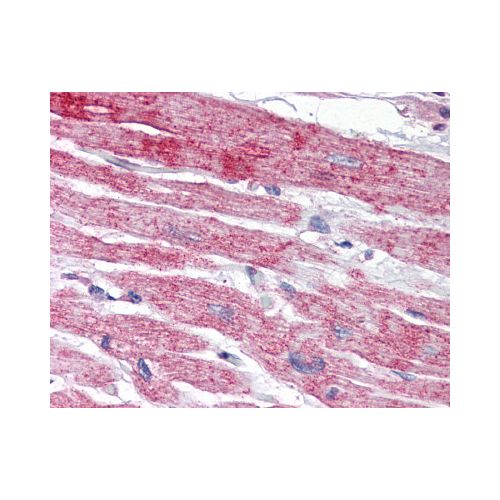 NPTX2 (Internal) antibody
