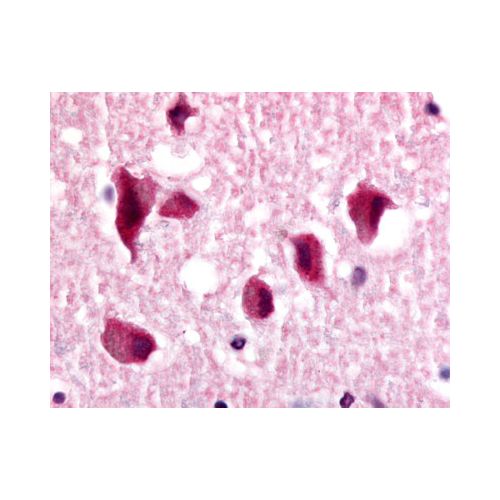 NR2E1 (N-Terminus) antibody
