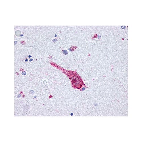 OPRM1 / Mu Opioid Receptor (C-Terminus) antibody