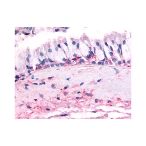 OR10J5 (Extracellular Domain) antibody