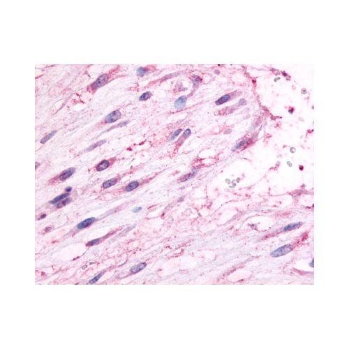 Oxytocin Receptor (C-Terminus) antibody