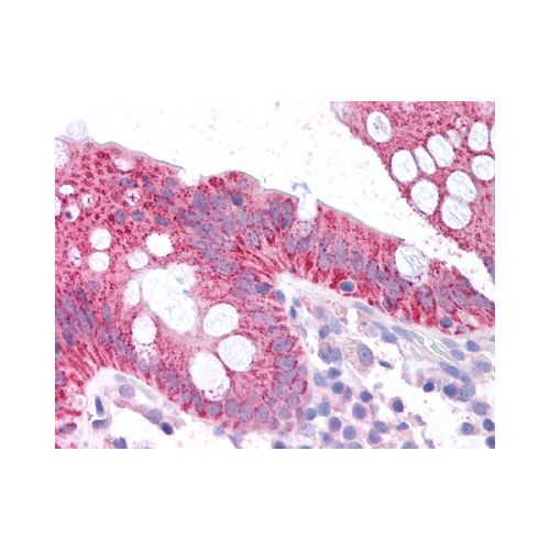 CDKN2A (N-Terminus) antibody