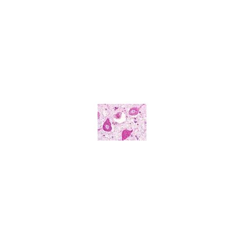 P2RY1 / P2Y1 (C-Terminus) antibody