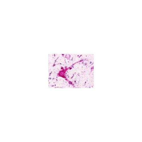 P2RY1 / P2Y1 (Extracellular Domain) antibody