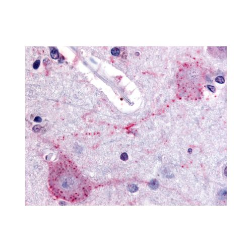 PACE4 (Internal) antibody
