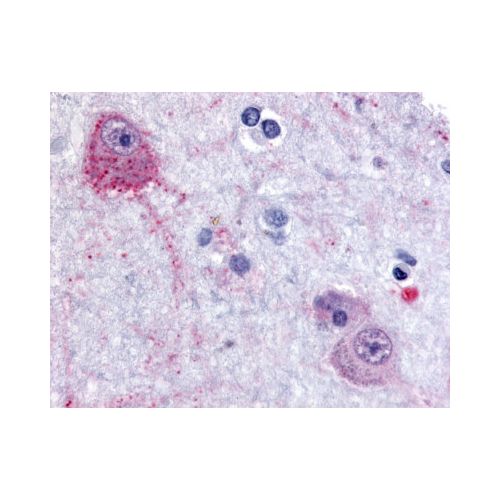 PACE4 (Internal) antibody