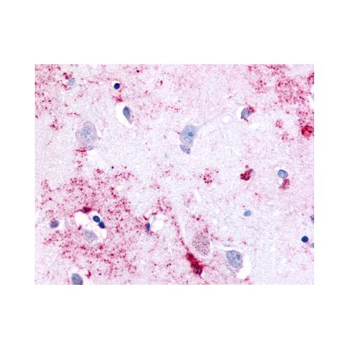 PAK6 (Linker Domain) antibody