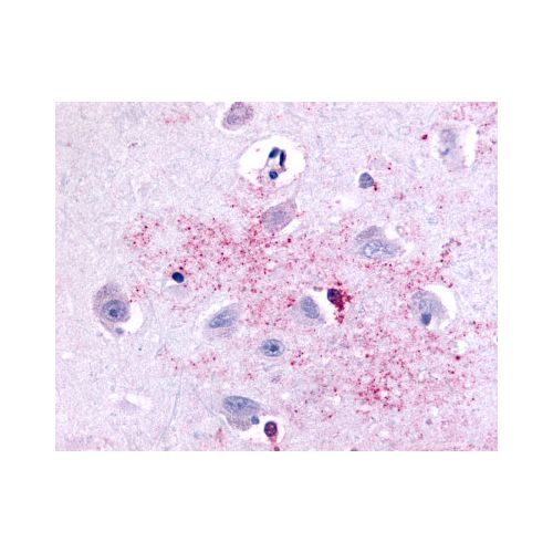 PAK6 (Linker Domain) antibody