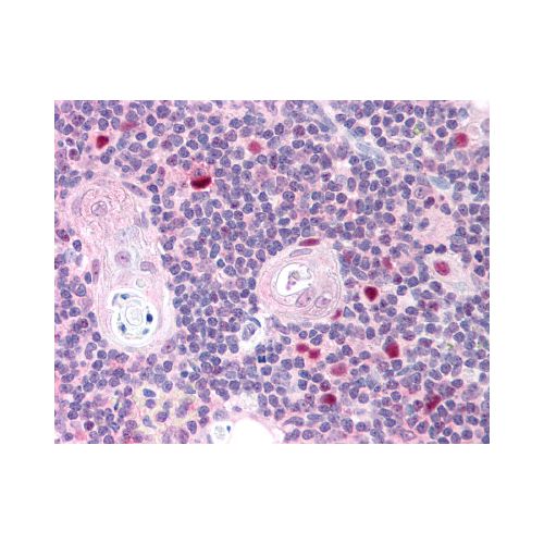 AIRE (Internal) antibody