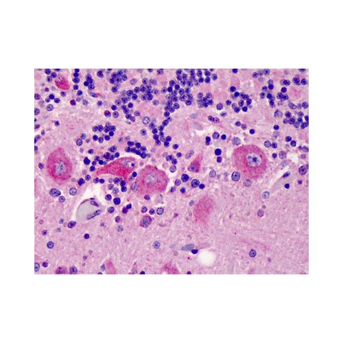 C5L2 (aa1-50) antibody
