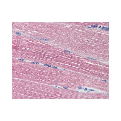 ACHE / Acetylcholinesterase (N-Terminus) antibody