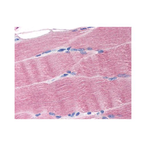 SLC40A1 (N-Terminus) antibody
