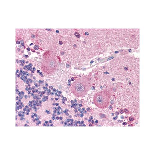 SLC6A3 / Dopamine Transporter (N-Terminus) antibody