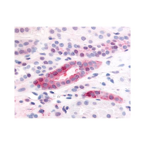 PDGF Receptor Beta (Extracellular Domain) antibody
