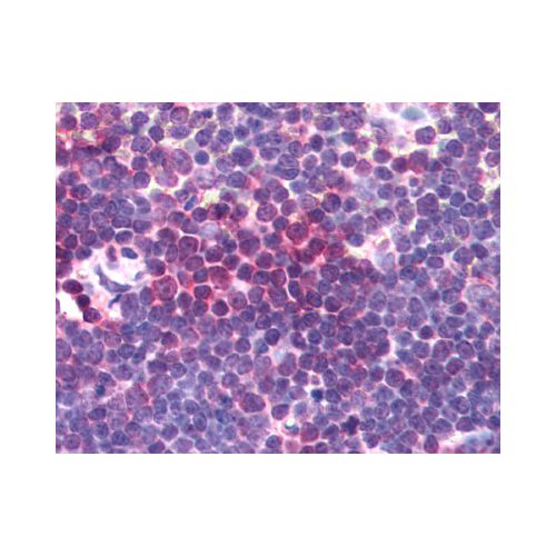 AURKA / Aurora-A (C-Terminus) antibody