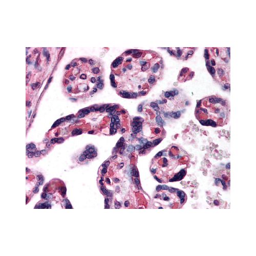 DKK1 (C-Terminus) antibody