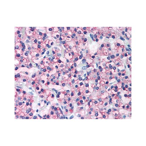 Parathyroid Hormone (aa53-84) antibody