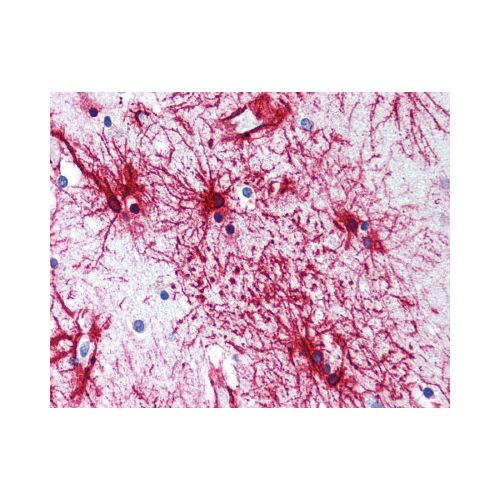 GFAP (C-Terminus) antibody