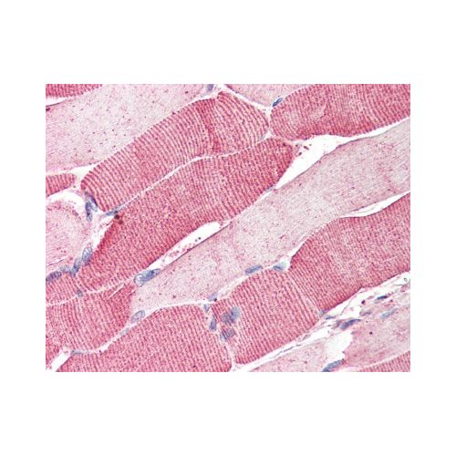 ARSB (Internal) antibody