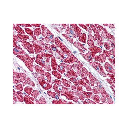 VDAC2 (C-Terminus) antibody