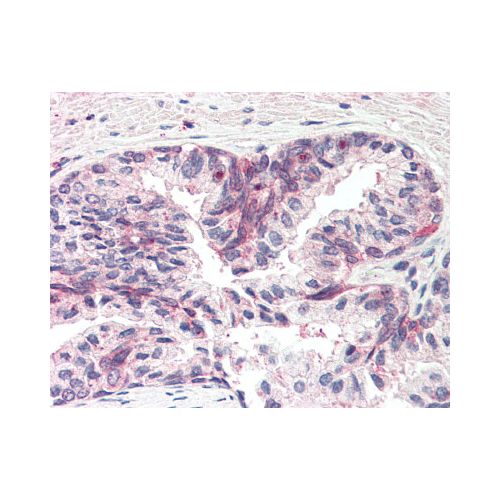 IHC : MSX1 (N-Terminus) antibody<br/>(pab72374)<br/>Anti-MSX1 antibody IHC of human prostate. Immunohistochemistry of formalin-fixed, paraffin-embedded tissue after heat-induced antigen retrieval. Antibody concentration 5 µg/ml.