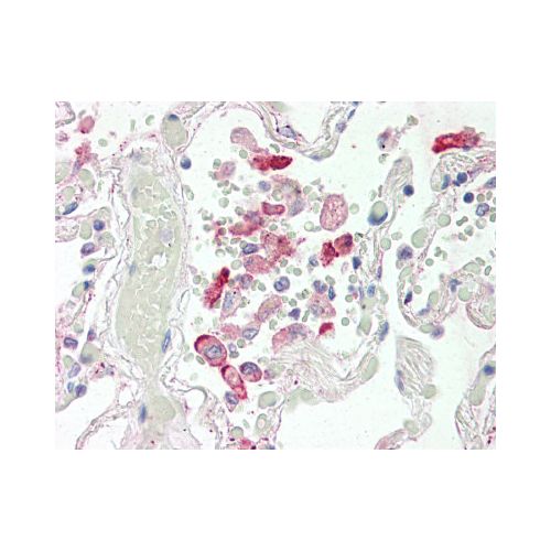 CES1 (Internal) antibody