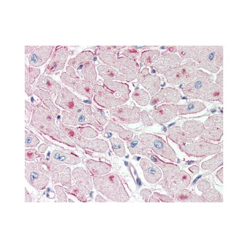 PNPLA2 / ATGL (Internal) antibody