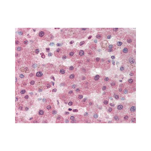 PC / Pyruvate Carboxylase (Internal) antibody