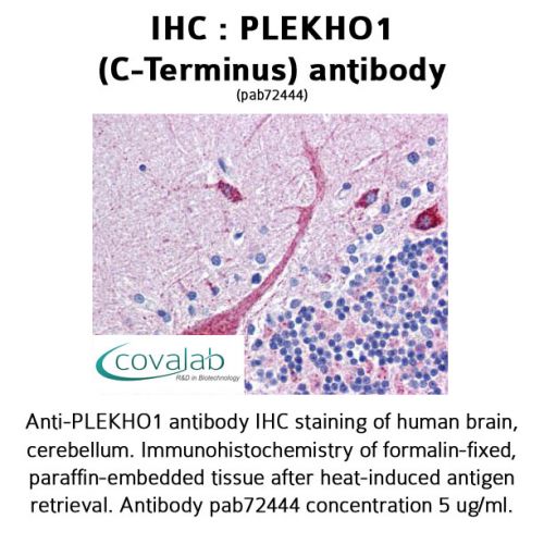 PLEKHO1 (C-Terminus) antibody