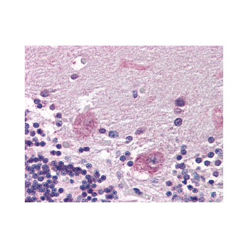 PPP2R3A (Internal) antibody