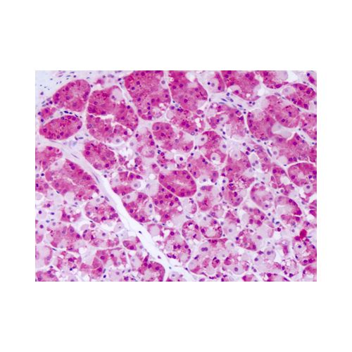 PRKD2 (Internal) antibody