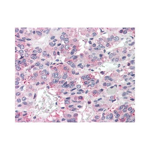 PRLHR / GPR10 (Extracellular Domain) antibody