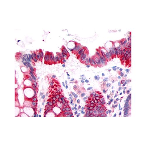 Prostaglandin D2 Receptor (Extracellular Domain) antibody