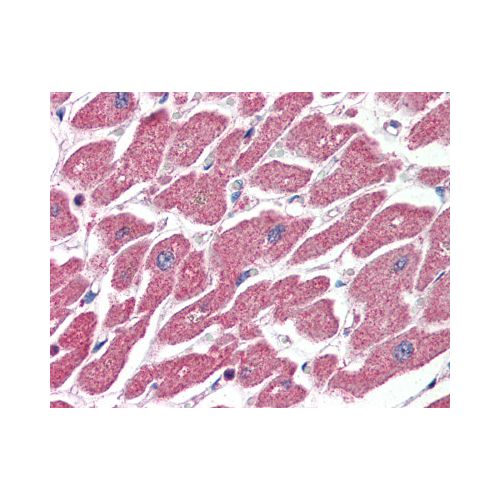 CPT1A (Internal) antibody