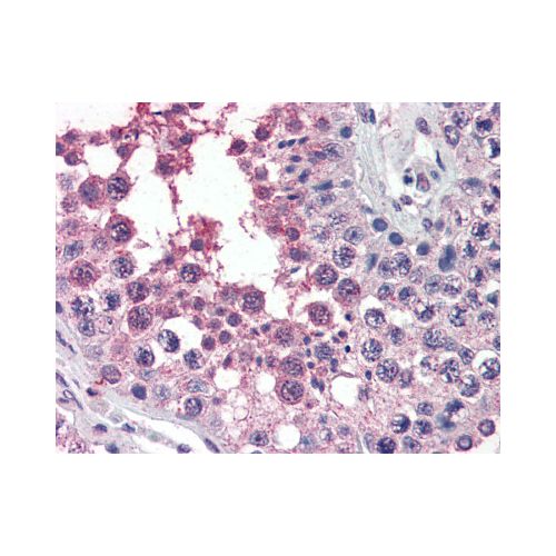 ACVR1 / ALK2 (Internal) antibody