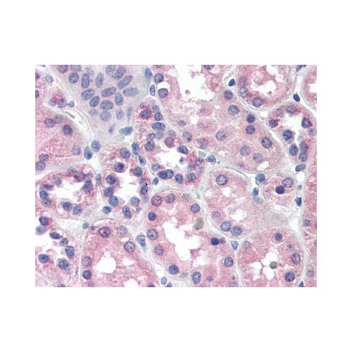 PCK1 (Internal) antibody