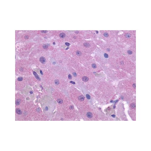 PTGFR (Extracellular Domain) antibody