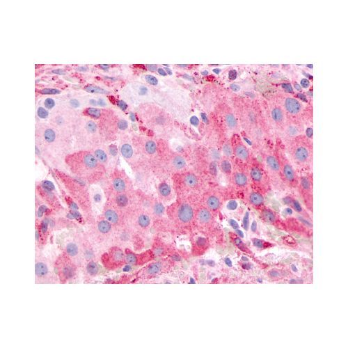 PTGFR (Extracellular Domain) antibody