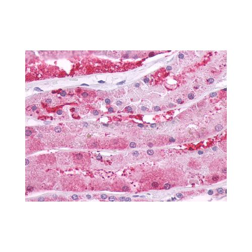 PTH1R / PTHR1 (N-Terminus) antibody