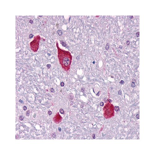 PTH2R / PTHR2 (C-Terminus) antibody