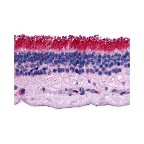 PTPRM (Internal) antibody