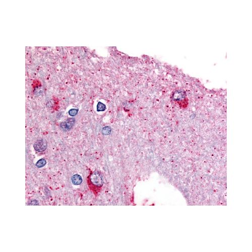 PYGB (Internal) antibody