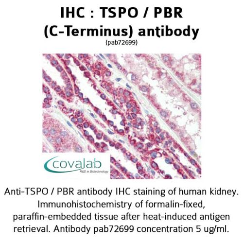 TSPO / PBR (C-Terminus) antibody