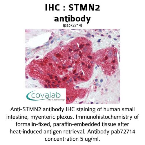 STMN2 antibody