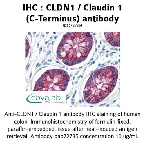 CLDN1 / Claudin 1 (C-Terminus) antibody