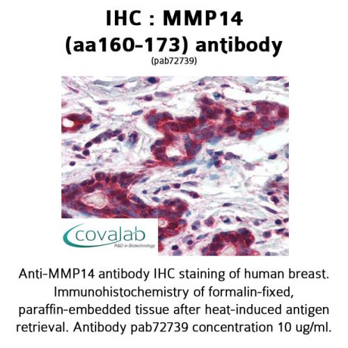 MMP14 (aa160-173) antibody