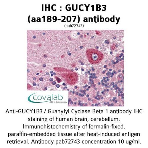 GUCY1B3 (aa189-207) antibody