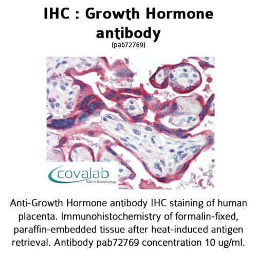 Growth Hormone antibody