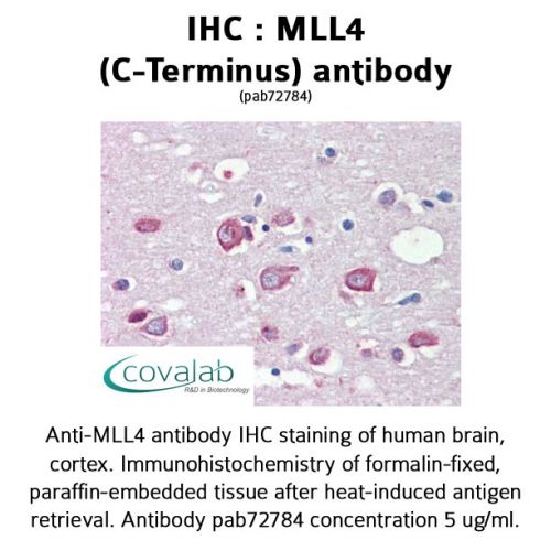 MLL4 (C-Terminus) antibody